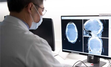 Cleveland Clinic advierte sobre el meningioma, el tumor cerebral más frecuente en adultos