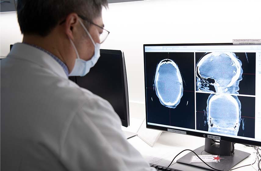 Cleveland Clinic advierte sobre el meningioma, el tumor cerebral más frecuente en adultos